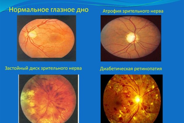 Кракен даркнет регистрация